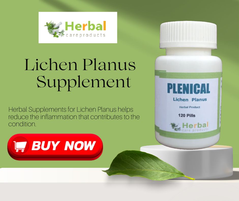 Herbal Supplement for Lichen Planus,USA,Hospitals,Public Hospitals